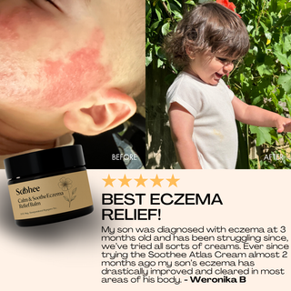 PureSoothe Eczema Relief Balm